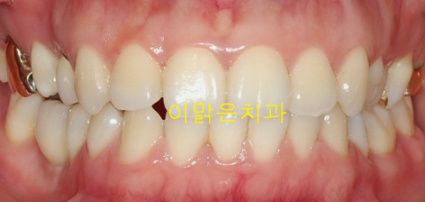 [승인대기] 관리자의 승인을 기다리고 있습니다.