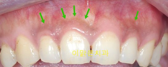[승인대기] 관리자의 승인을 기다리고 있습니다.